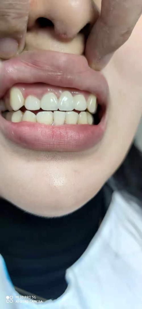 宇泽口腔全瓷牙补牙牙齿矫正中心评论
