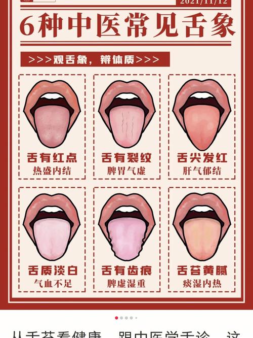 看舌知病