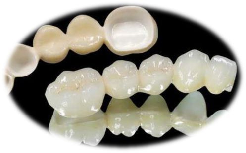氧化锆特性1适应症美容牙严重的四环素牙氟斑牙畸形牙变色牙等.