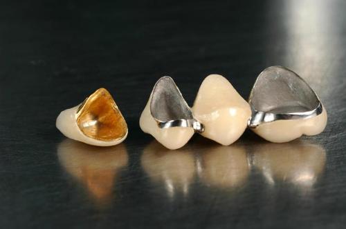 烤瓷牙影响牙齿功能吗