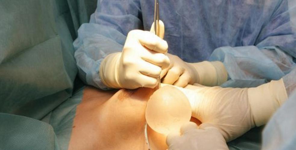 假体隆胸手术过程图片