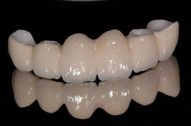 拥有一口整齐洁白的牙齿是现代人的主要健康标志之一随着医学的进步