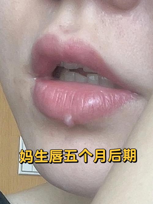 原相机记录广州纹唇一周及半年后期变化