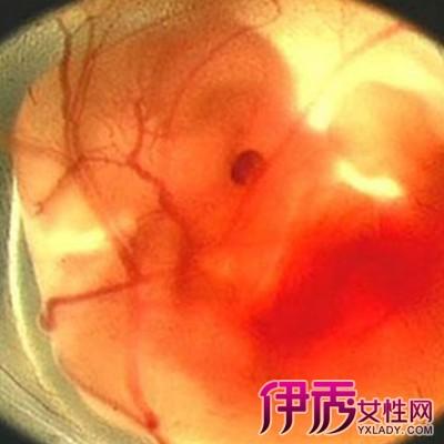 图胎儿两个月的样子图片一览